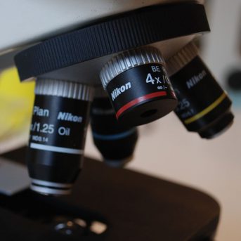 Onjuiste of te late diagnose