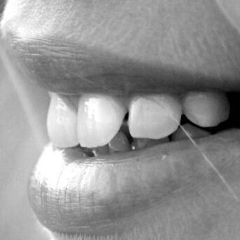 Stagebedrijf aansprakelijk voor tandletsel stagiair